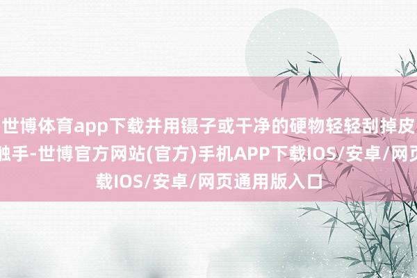 世博体育app下载并用镊子或干净的硬物轻轻刮掉皮肤上残留的触手-世博官方网站(官方)手机APP下载IOS/安卓/网页通用版入口
